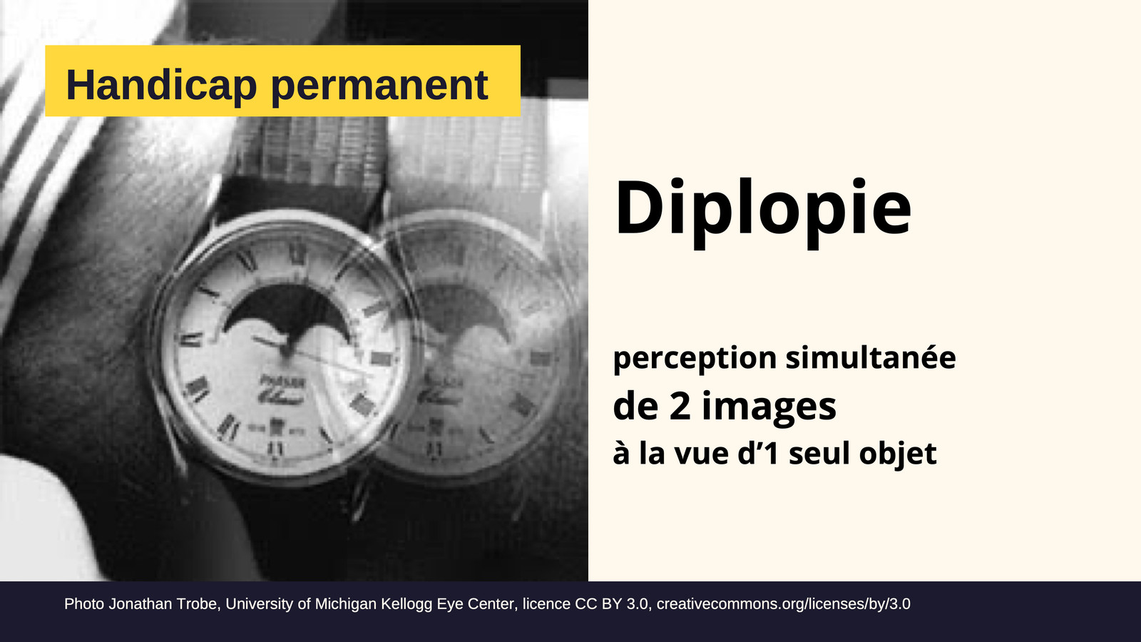Slide 13&nbsp;: Diplopie. Son texte suit.